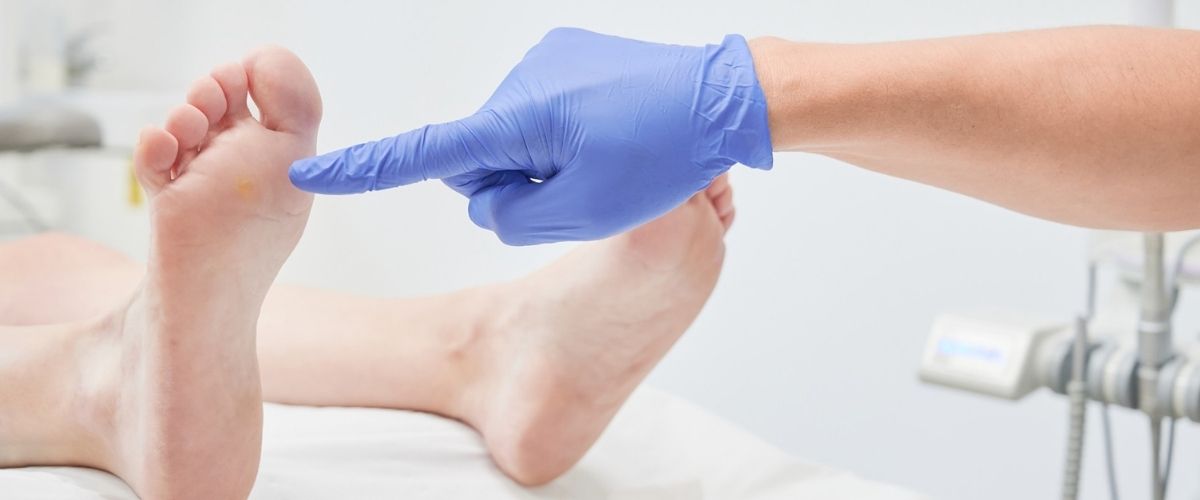 huehneraugen-entfernen