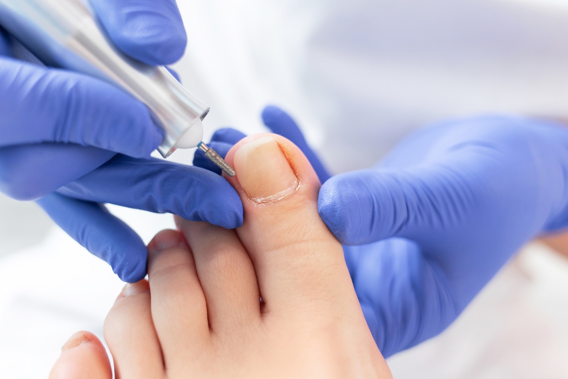 kosmetische-vs-medizinische-fusspflege-1